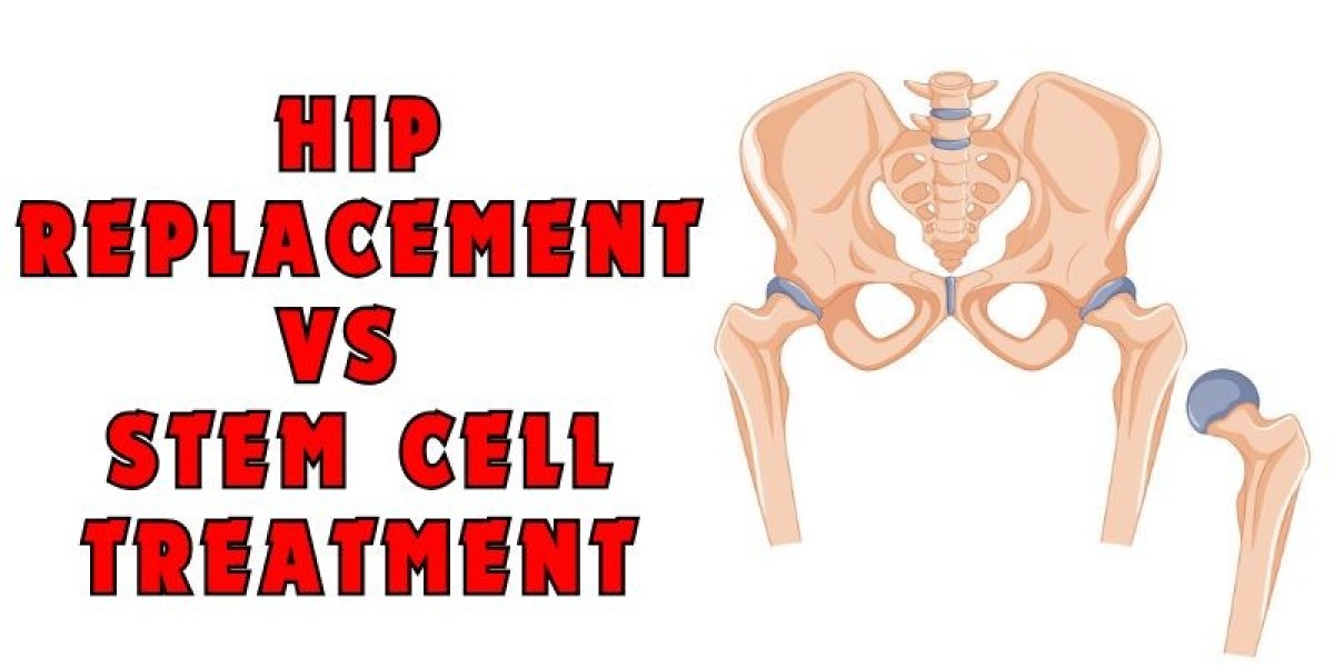 Modern Solutions for Hip Pain: Surgery or Stem Cells?
