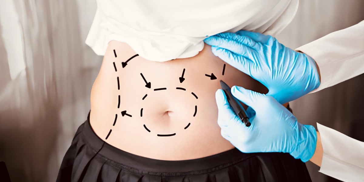 How to Choose the Right Tummy Tuck Type?
