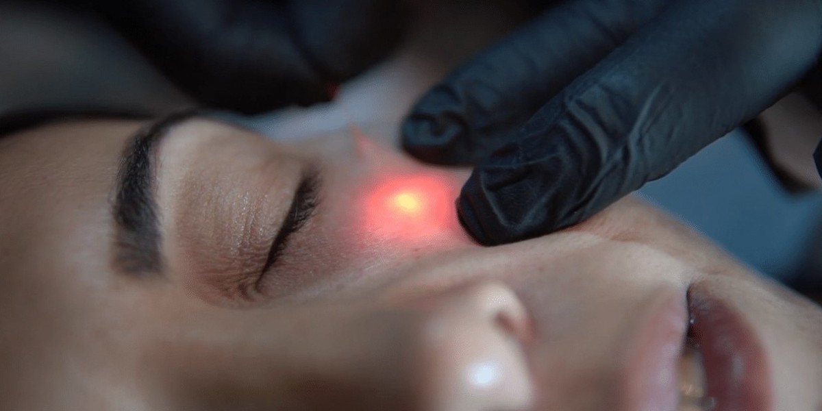Is Endolift Painful or Comfortable?