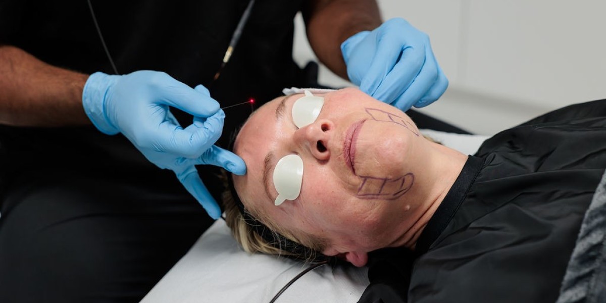 How does Endolift stimulate collagen?