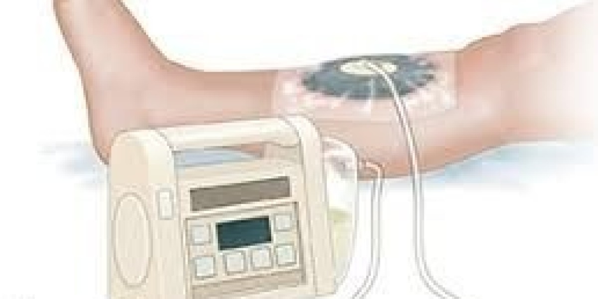 Global Negative Pressure Wound Therapy Market Outlook 2022–2032: Trends & Forecast
