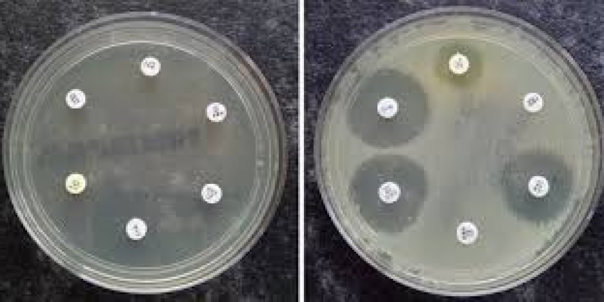 Antimicrobial Susceptibility Test Market Competitive Landscape Analyzed for Strategic Partnerships and Global Expansions