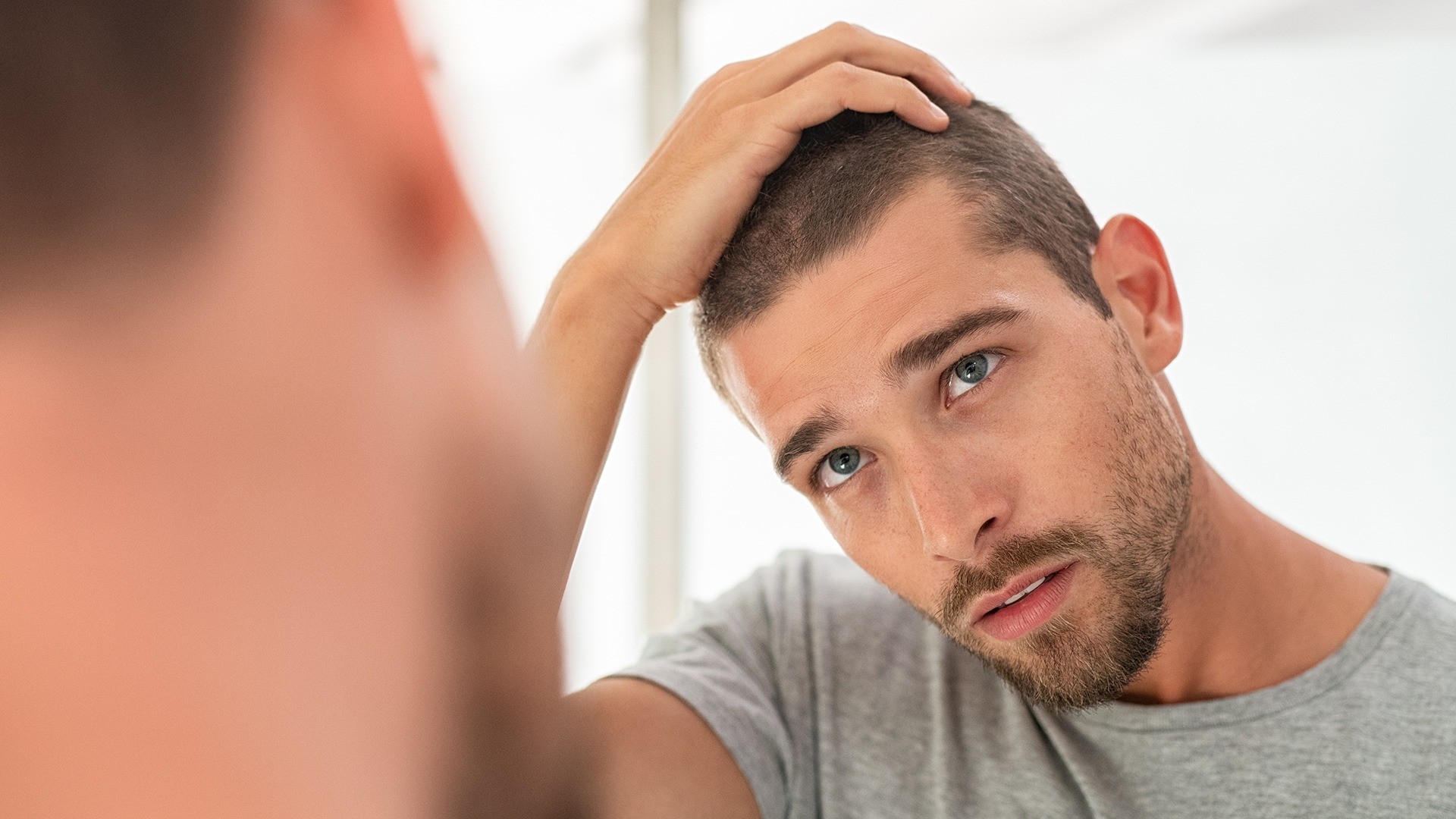 Finasteride 1mg Price in UAE