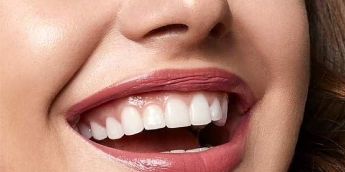 Emergency Dentist in Riyadh: Swift Solutions for Urgent Dental Needs