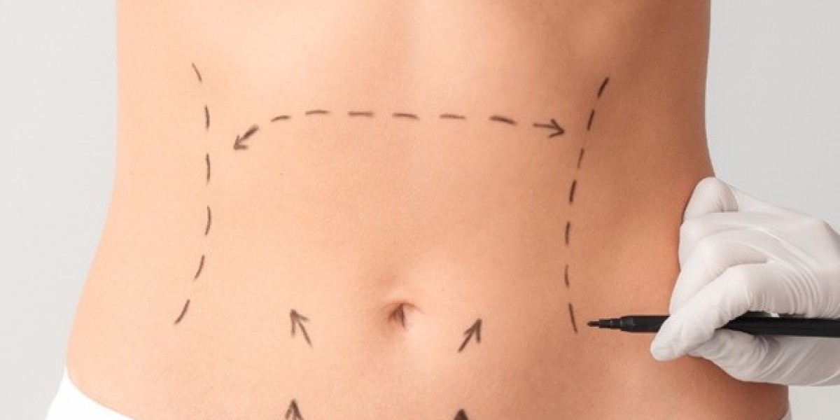 The Best Time to Get a Tummy Tuck in Islamabad: A Seasonal and Lifestyle Perspective