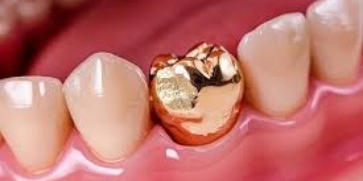 Tooth Filling Materials Market Growth Driven by Cosmetic Dentistry Trends and Rising Dental Health Awareness