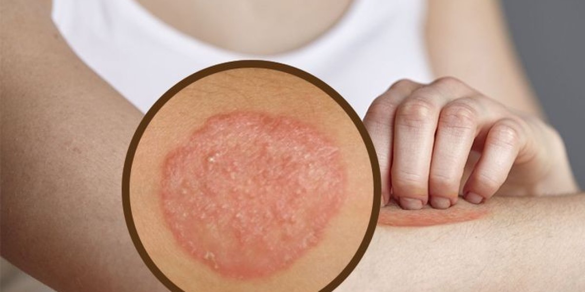 Everything You Need to Know About Mupirocin Ointment and T-Bact Ointment