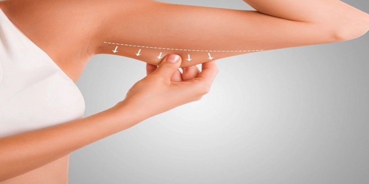 شد الذراعين: بين التجميل والضرورة الصحية – ماذا يقول الخبراء؟