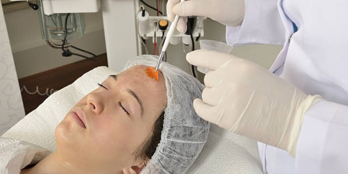 Top Skin Rejuvenation Method: Chemical Peels in Riyadh