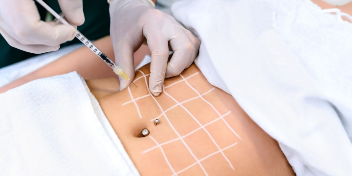 What Age Is Ideal for Fat Melting Injections?