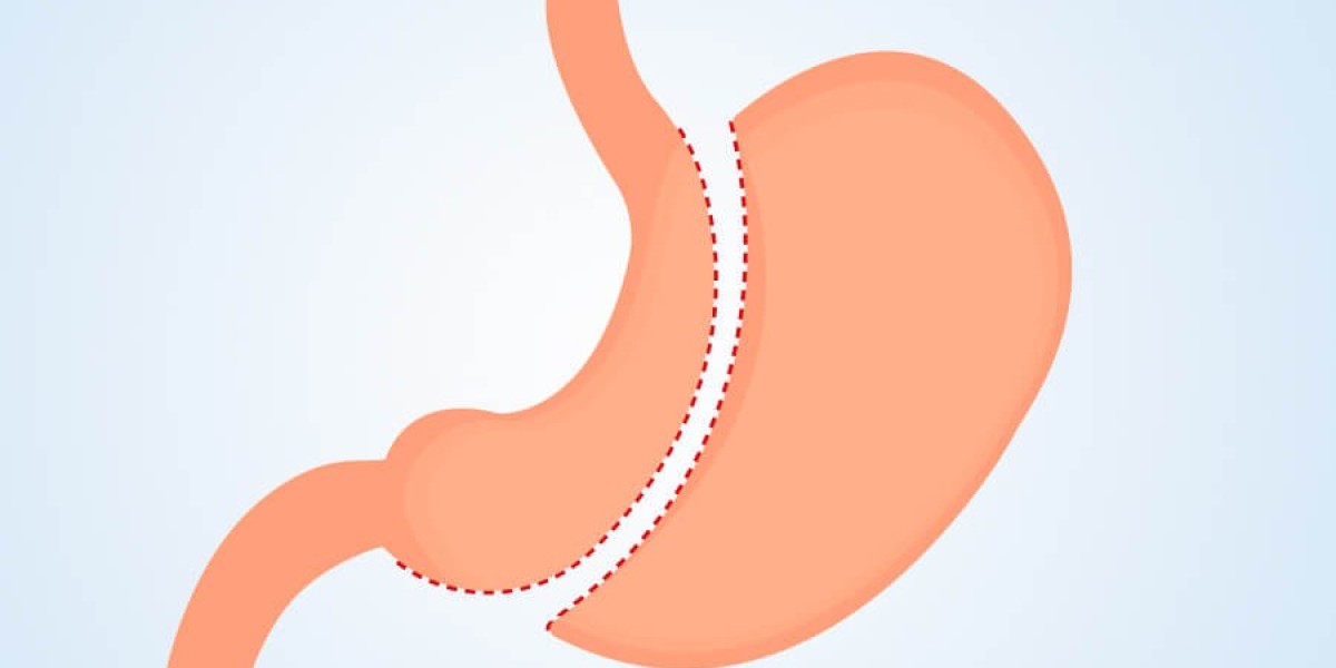 How to manage stress eating after surgery?