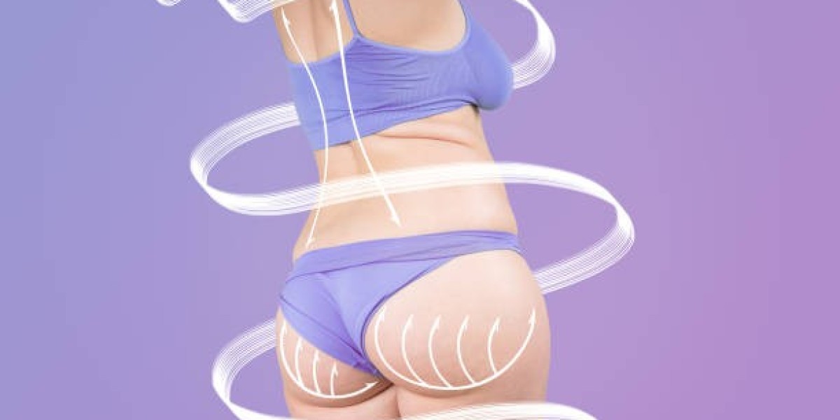 Is Thigh Lift Surgery Covered by Insurance in Riyadh?