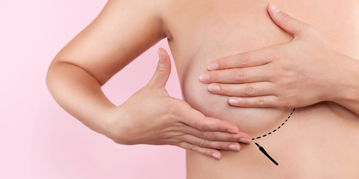 Affordable Breast Reduction Options in Riyadh
