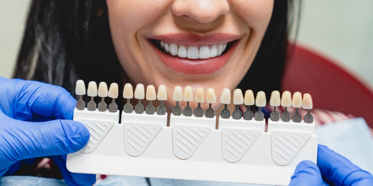 Do Veneers Hurt? The Truth from Islamabad Dentists
