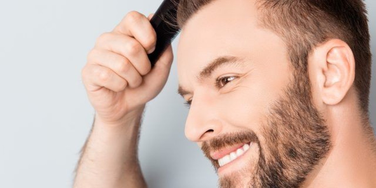 What to Expect from a Hair Transplant in Riyadh: A Comprehensive Guide