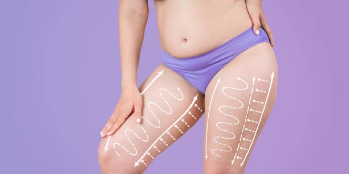 Thigh Lift Surgery Risks in Riyadh