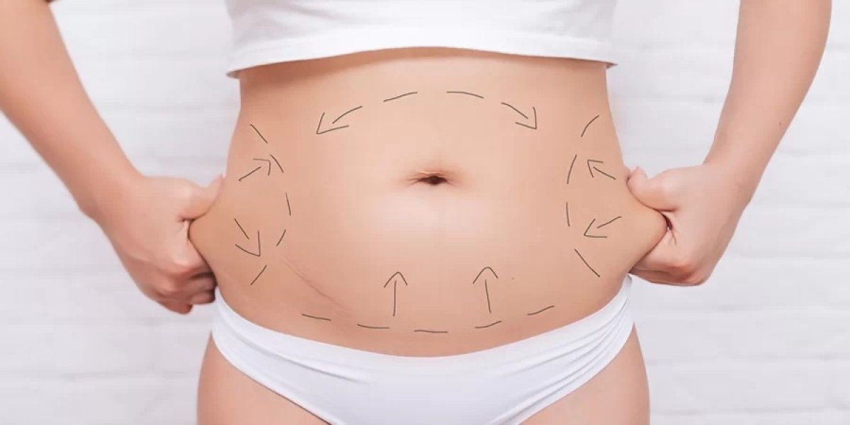 Tummy Tuck Recovery in Islamabad: Do's and Don’ts