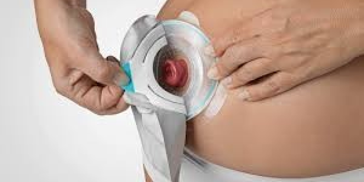 Ostomy Devices Market and User Safety