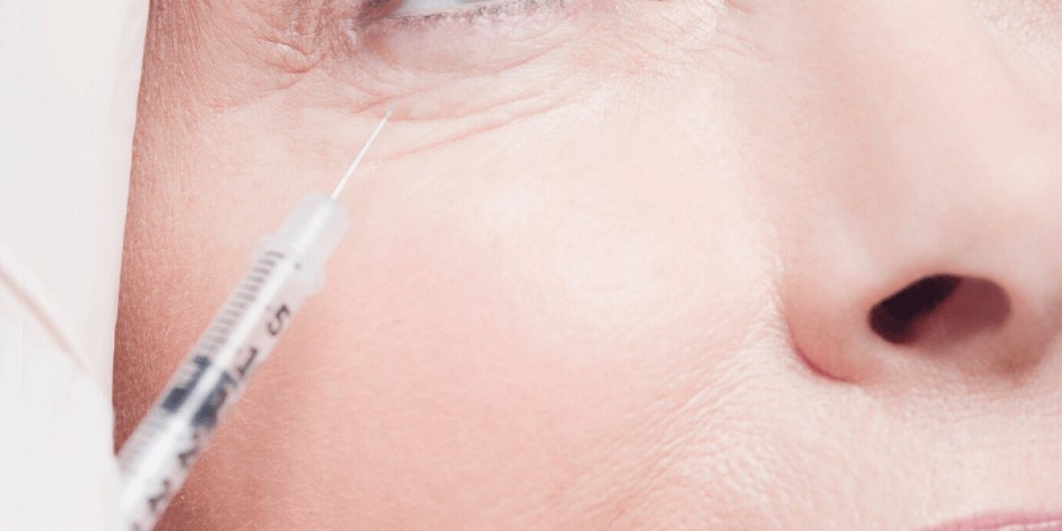 Are Under Eye Fillers Good for Fine Lines?