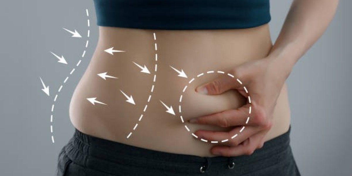 Tummy Tuck in Dubai: Your Complete Guide to a Flat, Sculpted Look