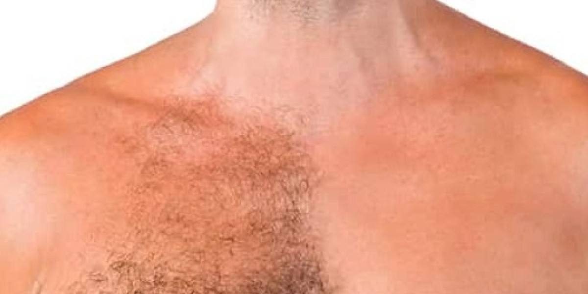 How Safe Is Body Hair Transplant Surgery?