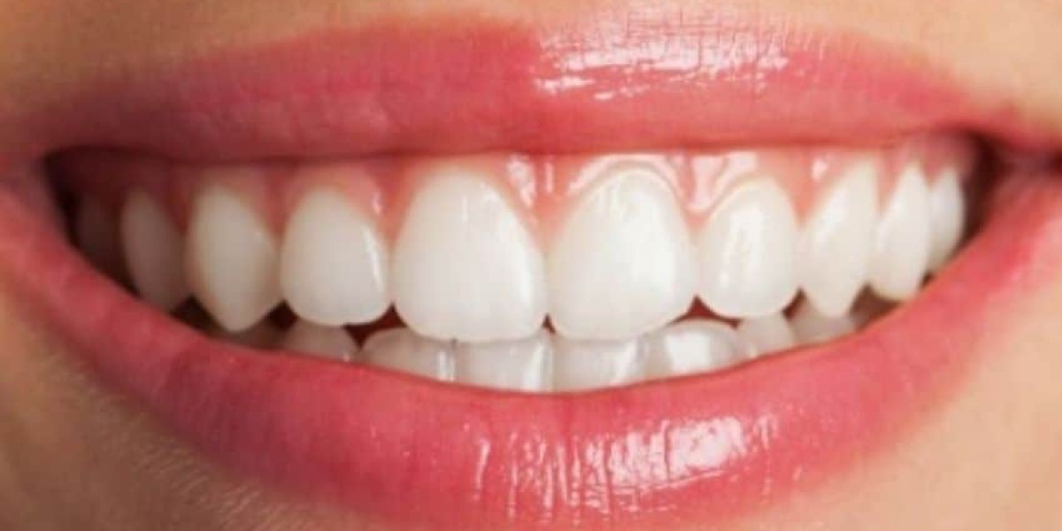 Teeth Whitening and Dating: First Impressions Matter