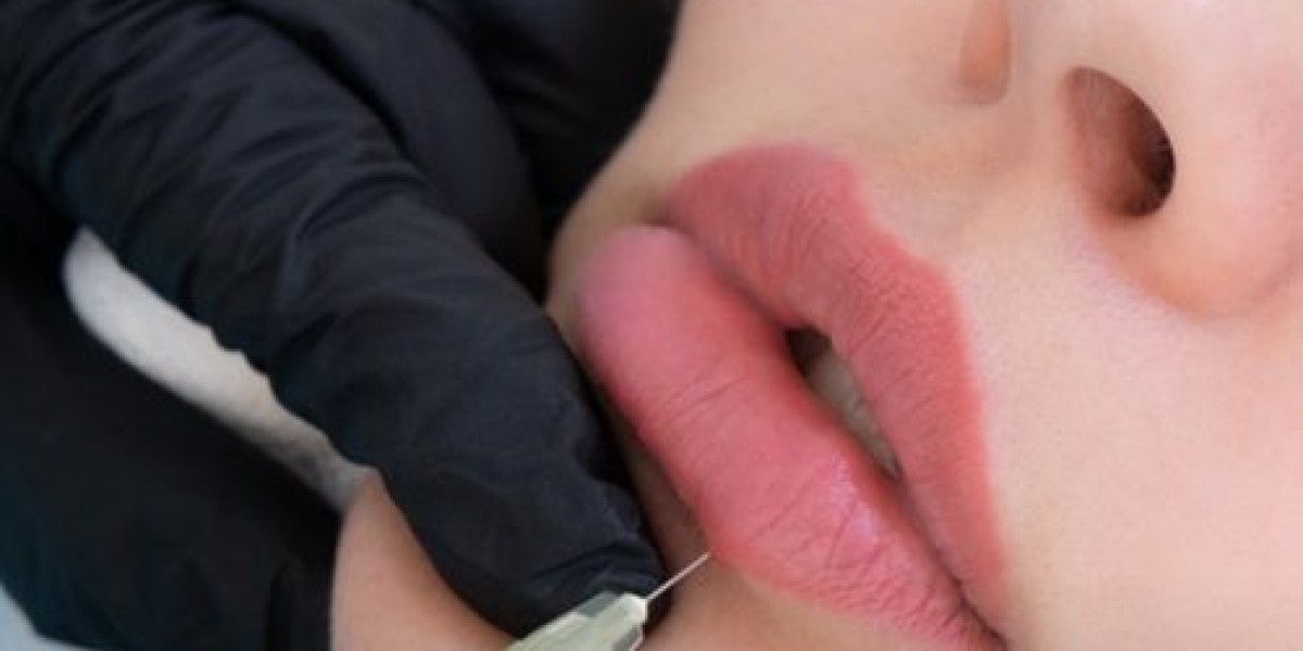 Can Russian Lip Fillers Improve Lip Symmetry?