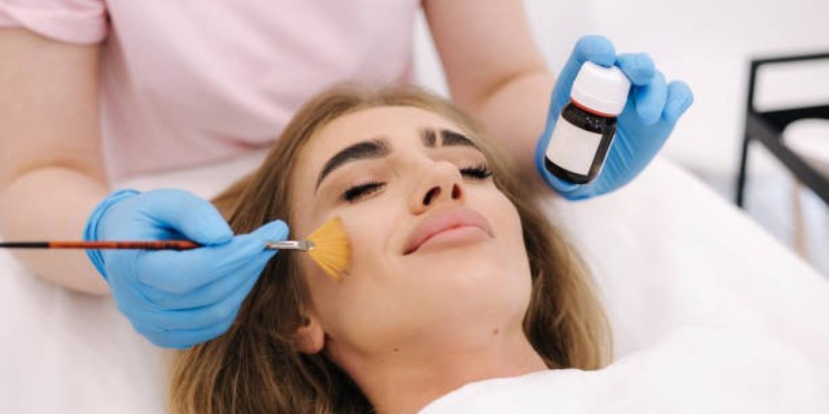 Best Types of Chemical Peels in Riyadh