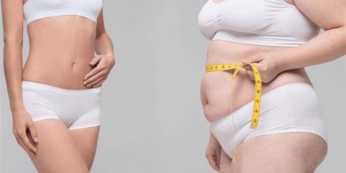 Weight Loss Surgery Cost in Islamabad – Full Breakdown