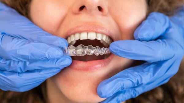invisalign Perth