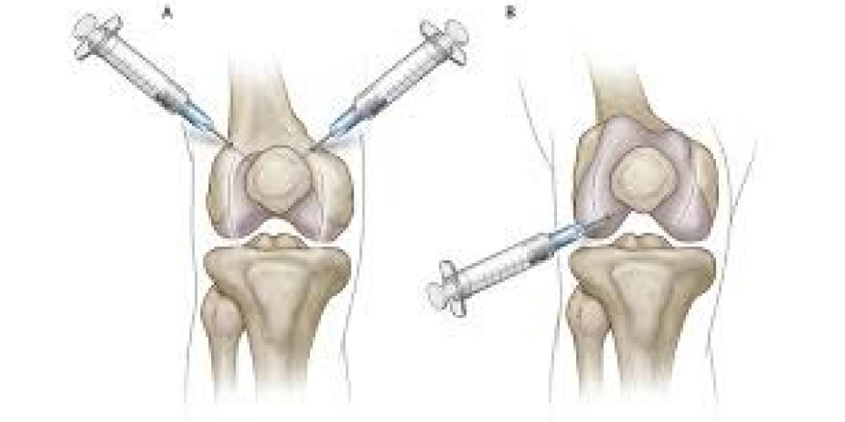 Viscosupplementation Market Key Challenges