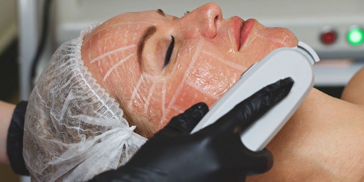 How Does Hifu Treatment Tighten the Skin?