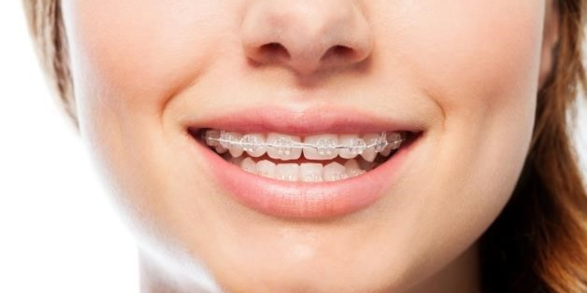 How Full Mouth Rehabilitation Can Correct Severe Overlapping Teeth