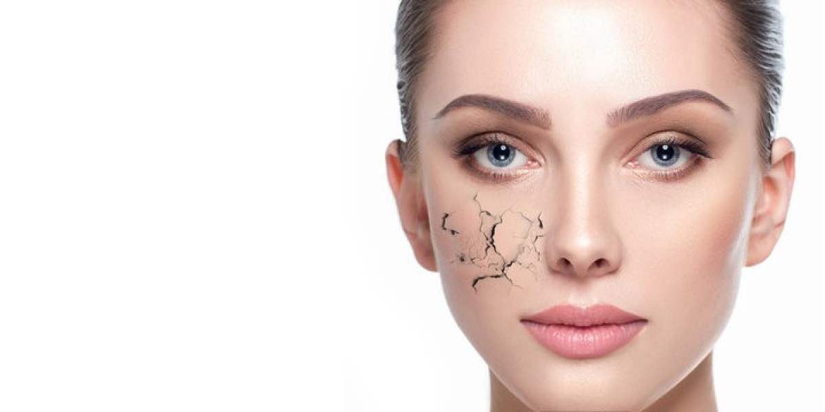 What are the most effective clinical treatments for dry skin?