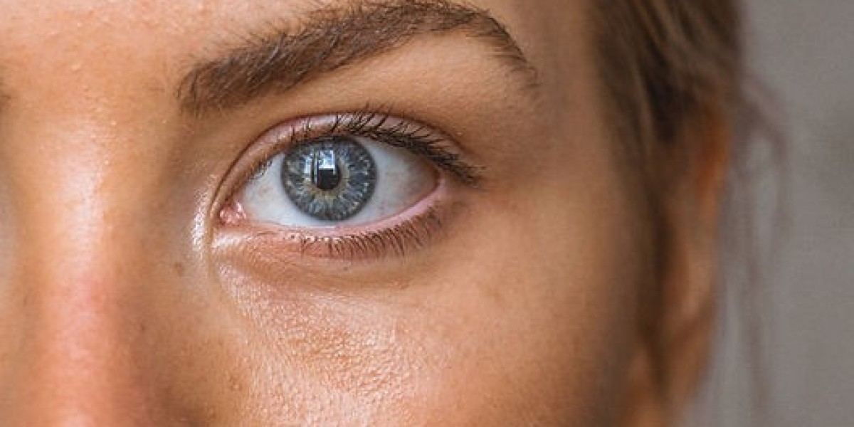 Are Dark Circles Treatment Safe for Sensitive Skin?