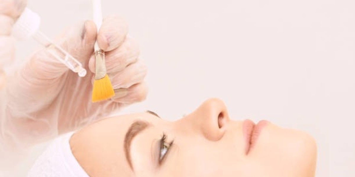 Experience Radiant Skin: Unveiling Chemical Peel Results in Riyadh