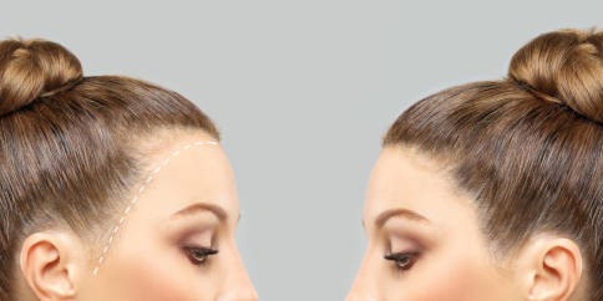 زراعة الشعر في الرياض – استعد مظهرك الطبيعي بثقة عالية