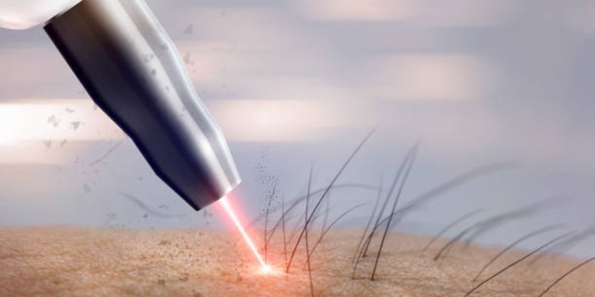 Electrolysis Dubai: Best Clinic Rates