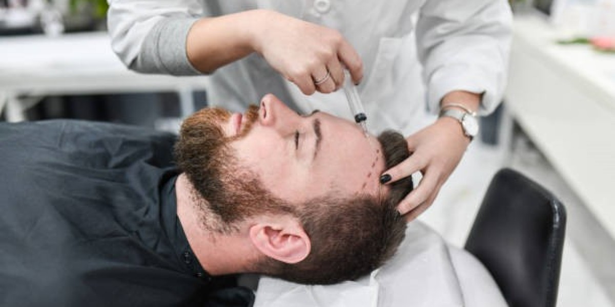 الزراعة الشعر: ما يجب معرفته عن التعافي والعناية اللاحقة