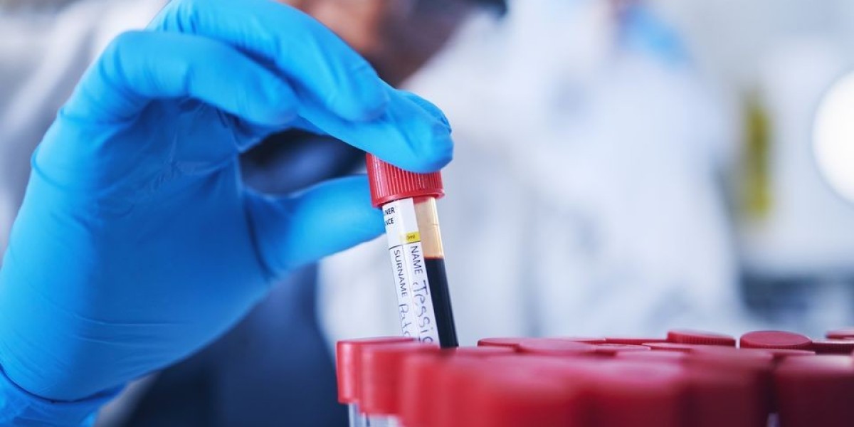 Sleep Disorder Biomarkers in Blood Test at Home