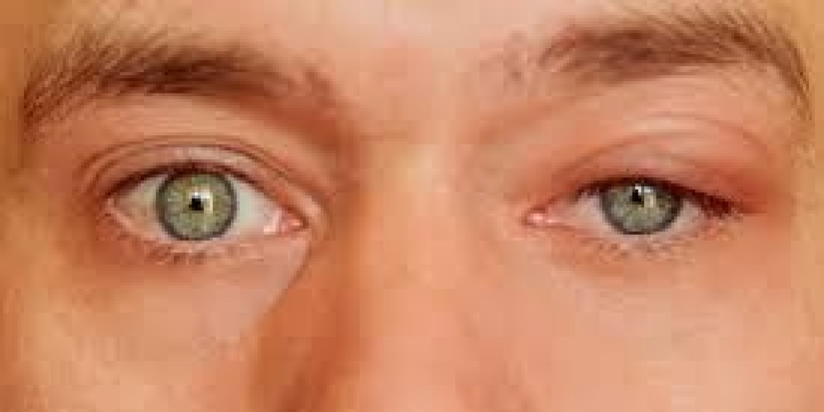 Post-Surgery Dry Eye: Expert Insights from Leading Eye Surgeons