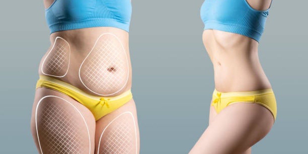 Jeddah's Top Thigh Lift Options