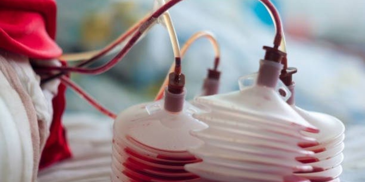 Global Surgical Drainage Devices Market Size, Share, Analysis and Forecast 2021 – 2030