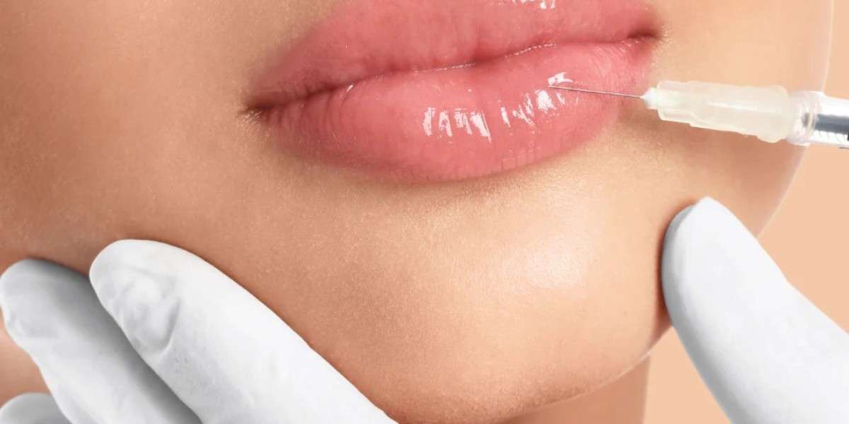 Is There Downtime After Juvederm Fillers?
