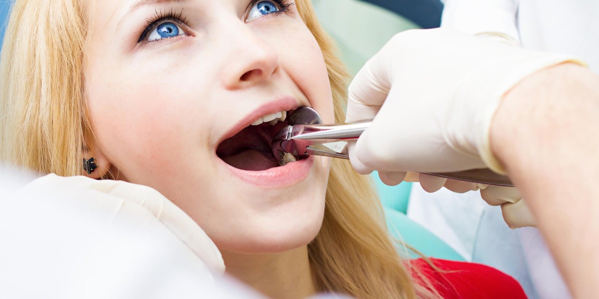 Does Tooth Extraction Cost Cover Aftercare Supplies?