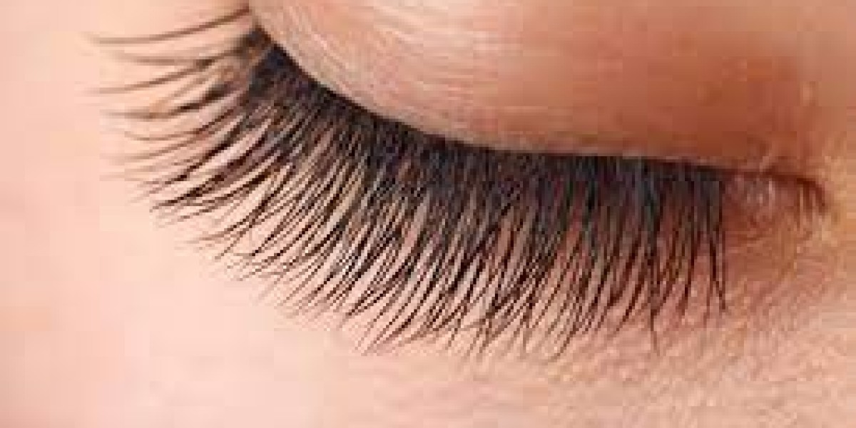 What Are the Steps Involved in Eyelash Hair Transplant?