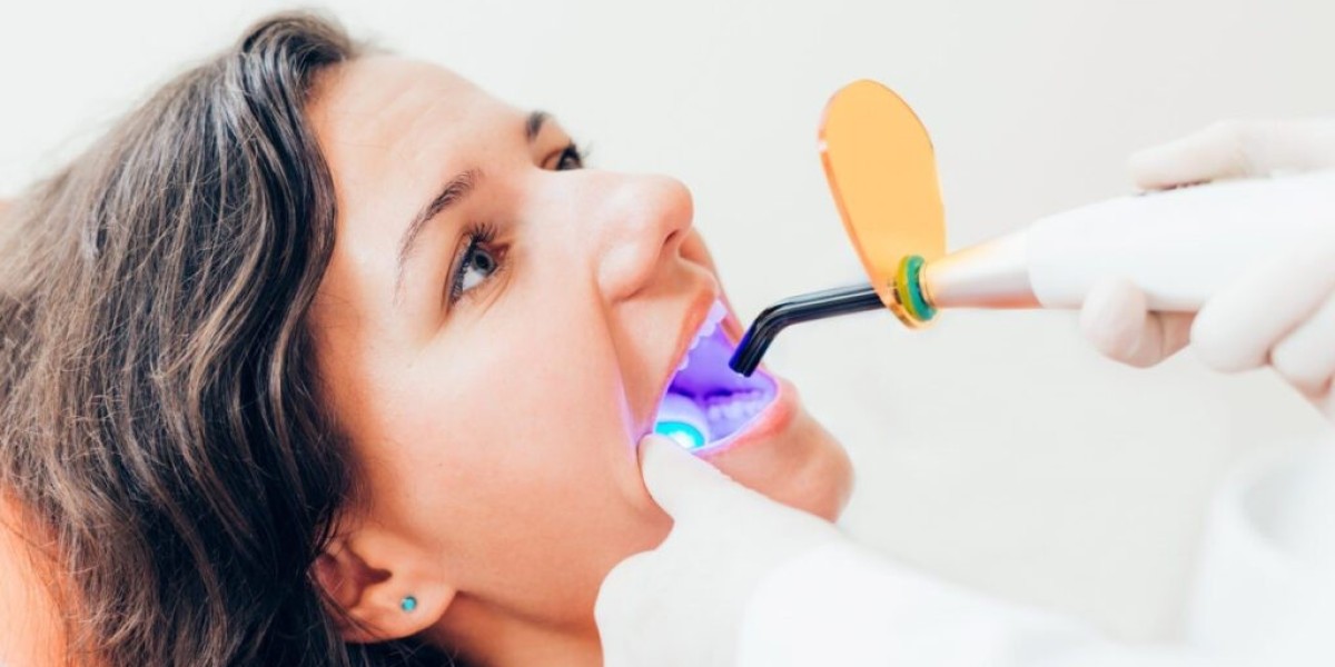How to Prevent Cavities and Avoid Needing Fillings