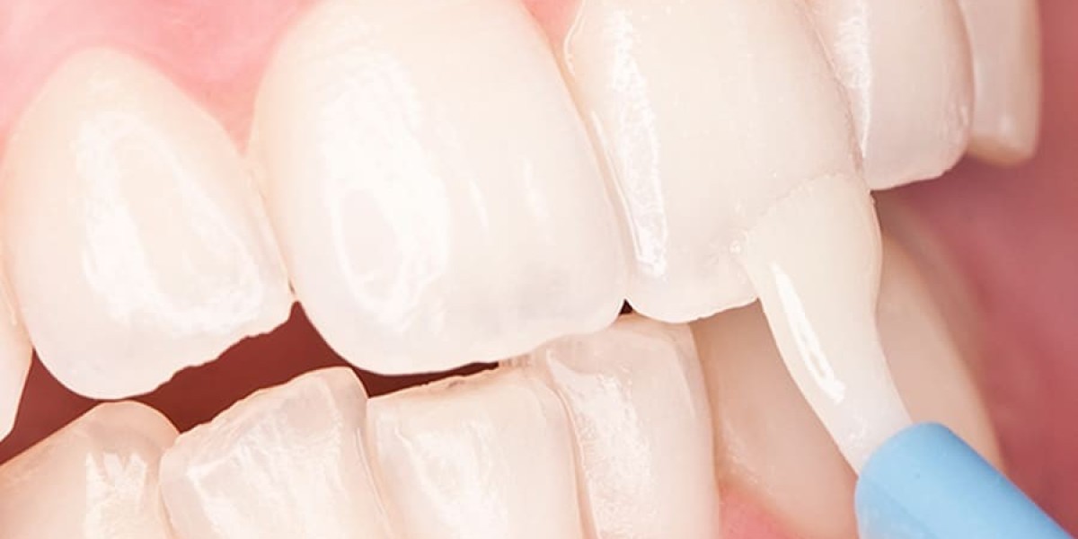Teeth Desensitizer Market Research Uncovers Investment Opportunities and Evolving Consumer Preferences