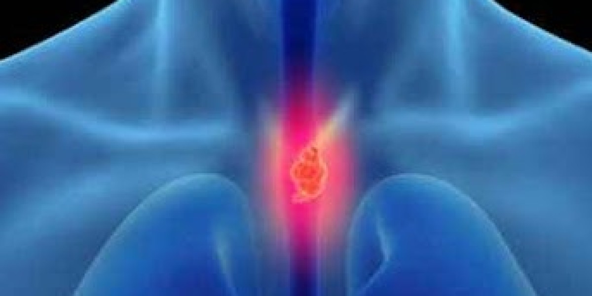 Barrett’s Esophagus Market Analysis | Treatment Trends and Forecast