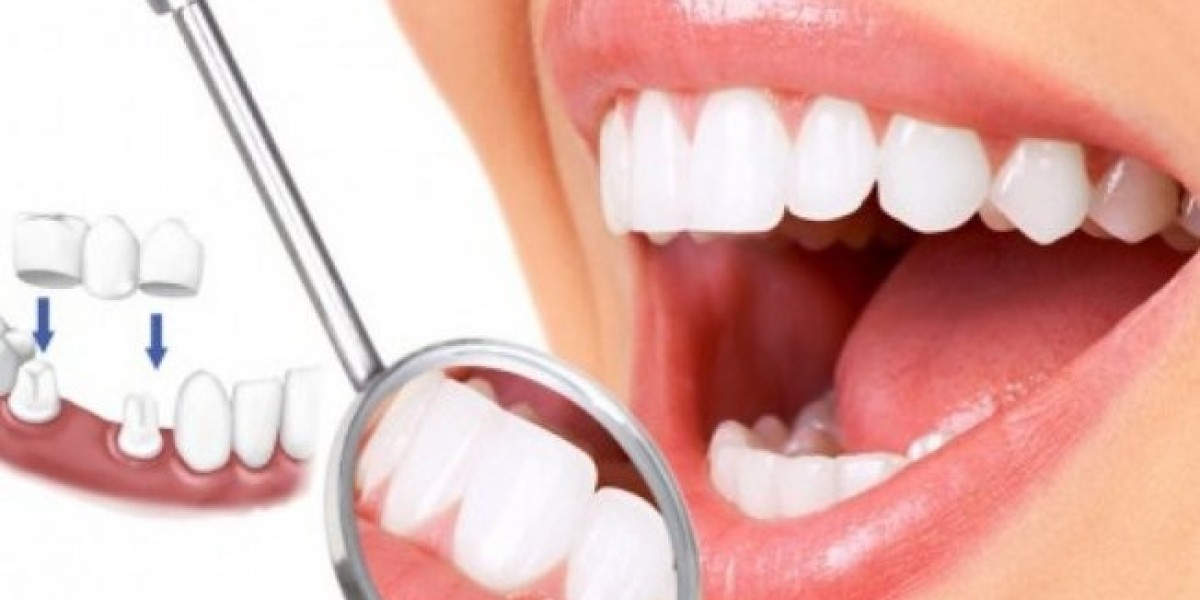Phòng khám nha khoa Vĩnh Yên gần đây nhất: Lựa chọn đúng để chăm sóc răng miệng an toàn